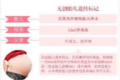 上海如何做胎儿亲子鉴定的医院在哪?